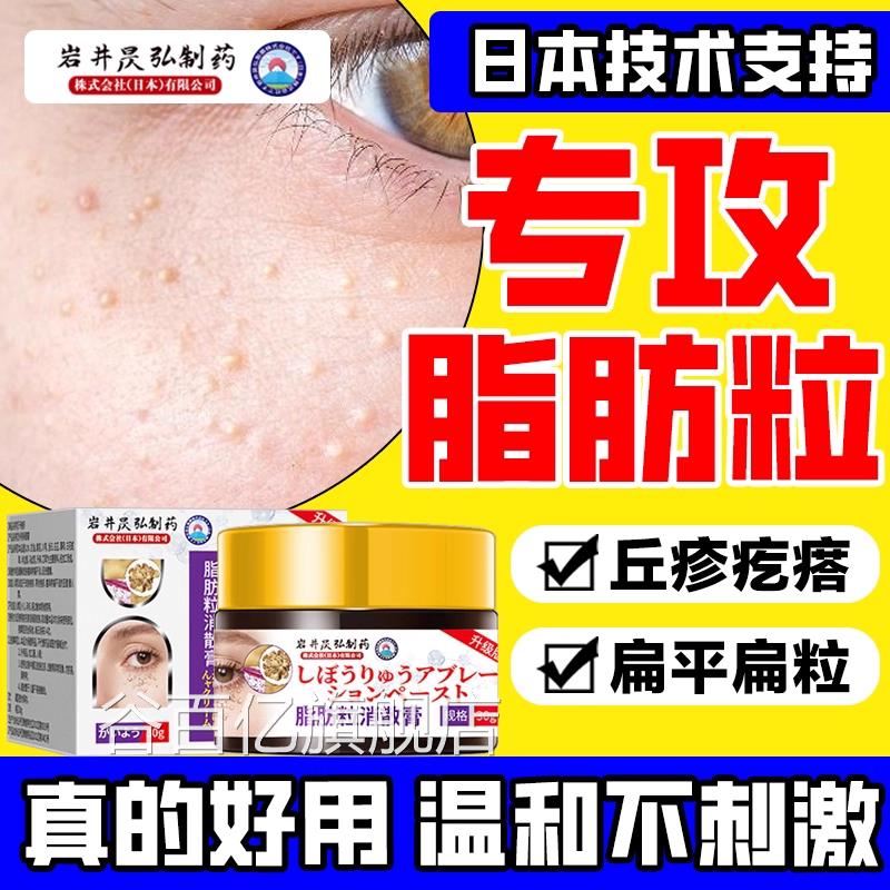 日本专研部脂肪粒乳膏专用膏扁平粒深层渗透疏通毛眼囊正品旗舰店