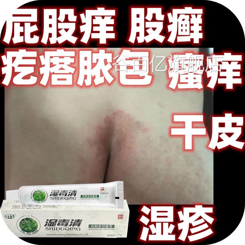 屁股痒坐疮膏屁股上有起疙瘩久坐长痘痘生板疮痱子屁股红热乳膏谷