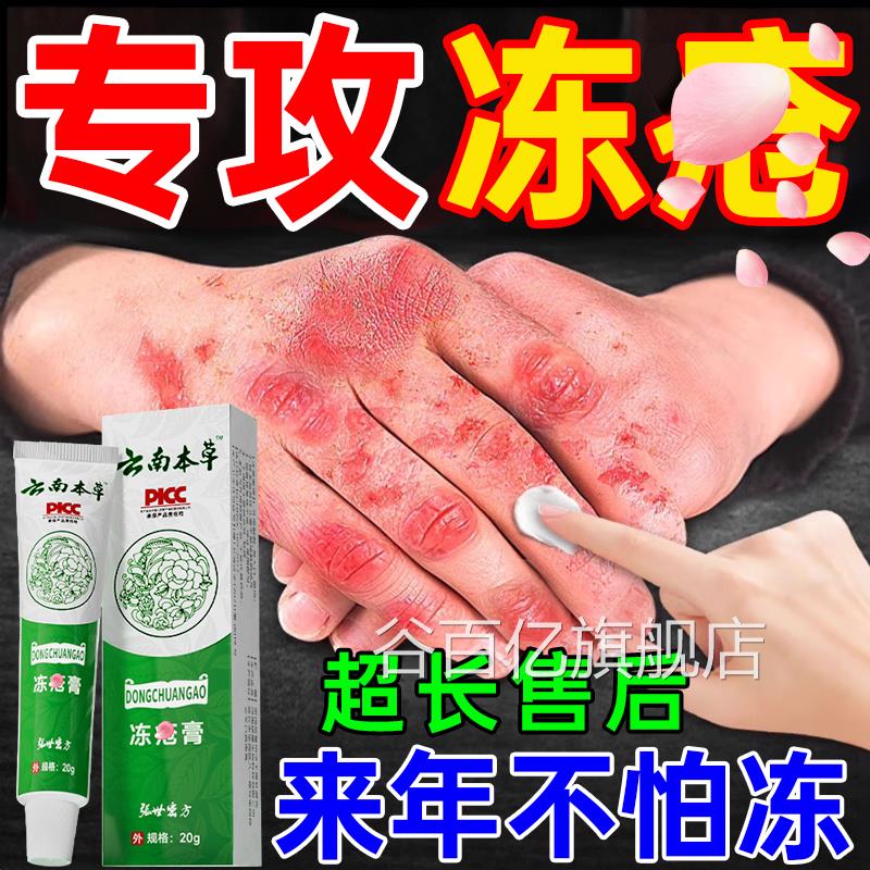 冻膏止痒冻伤膏正品疮官方旗店排行榜第效特儿童耳朵消肿药一舰名
