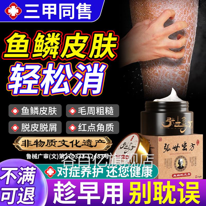 鱼鳞病皮肤霜专非用干燥起皮屑去蛇鸡皮肤膏止身体乳保湿滋润瘙痒