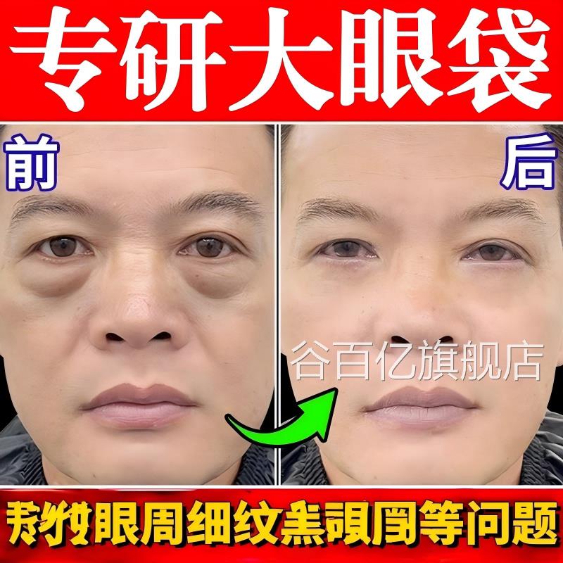 眼袋排肿膏消液严重肿强力去眼消士除袋神男器一分钟克专用霜星谷