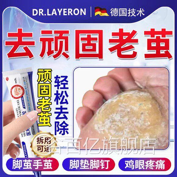 祛脚底上老茧脚钉鸡茧眼硬去除膏专用去垫死厚皮软化剂根药神器BT