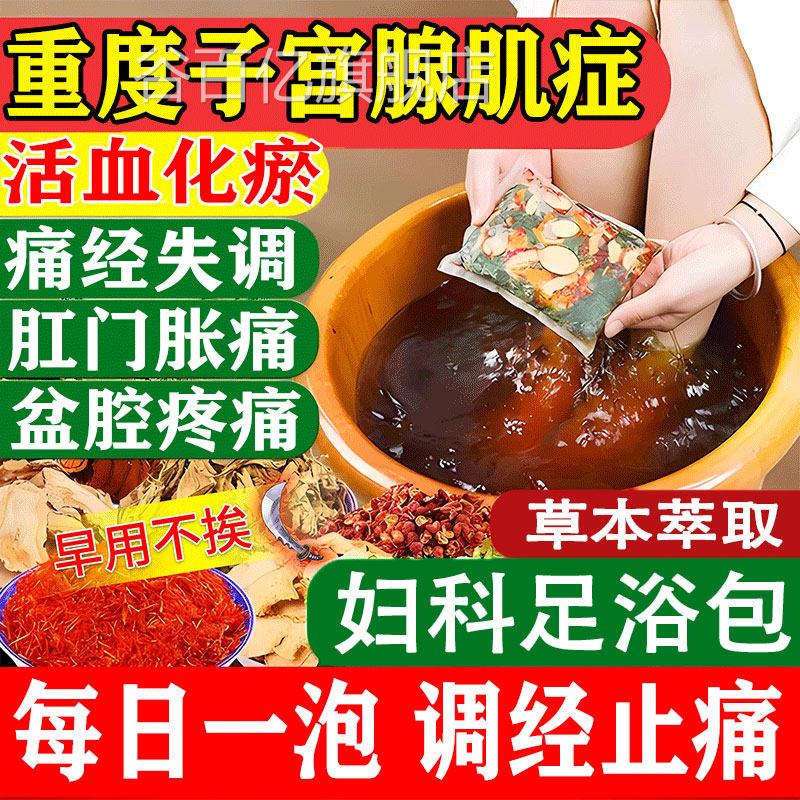 子宫腺肌的症药内膜异位宫寒痛经纤维肌瘤中药贴泡脚包调理盆腔GX