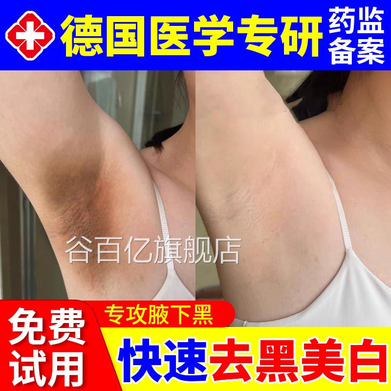 腋下去黑美白腋窝除黑色素沉淀淡大腿内侧黑脖子化沉着淡化谷百亿