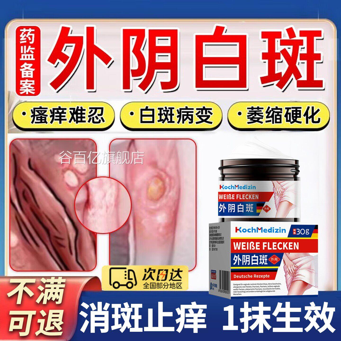 外阴白斑专用膏止痒去萎缩瘙痒根营养不良白斑净星白斑克阴道炎谷