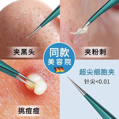 PLYS黑头细胞夹超细粉刺夹超尖黑头夹镊子清痘刮去闭口美容院专用