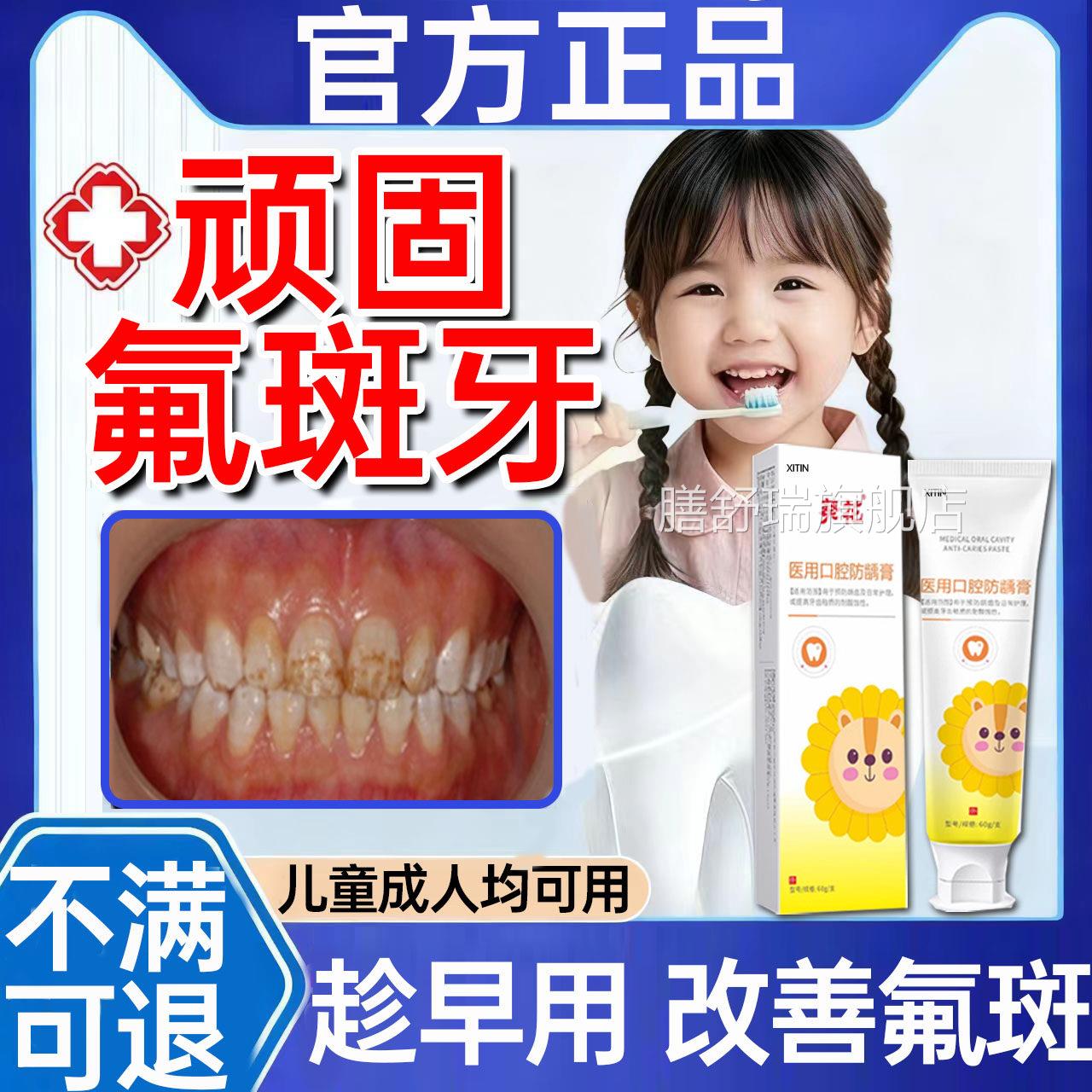 氟斑牙去除专用牙膏变白神器稀盐酸儿斑童牙齿白斑黄褐色祛牙菌PP