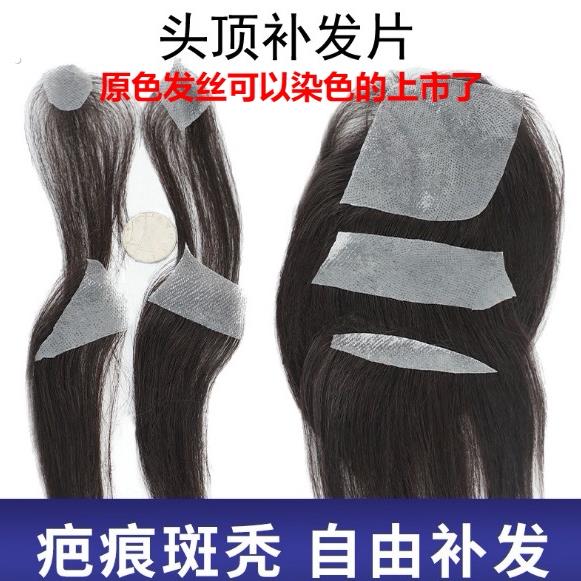 真人假发贴片隐形小面积疤痕斑秃发块头套疤痕补发贴黏贴假发自粘