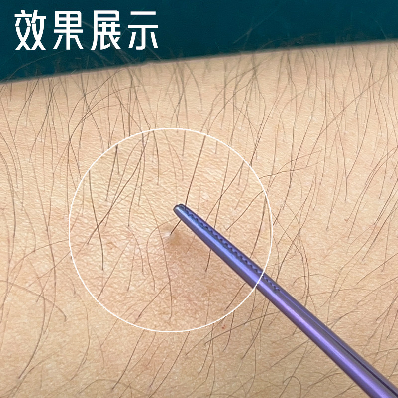 专业采耳工具手工打磨炫彩镊子挖耳细尖镊子掏耳夹子夹耳屎神器