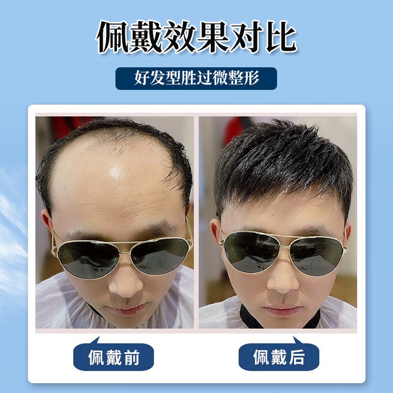 假发男纳米网短发全真发假发片自然隐形无痕01轻薄男士头顶补发块