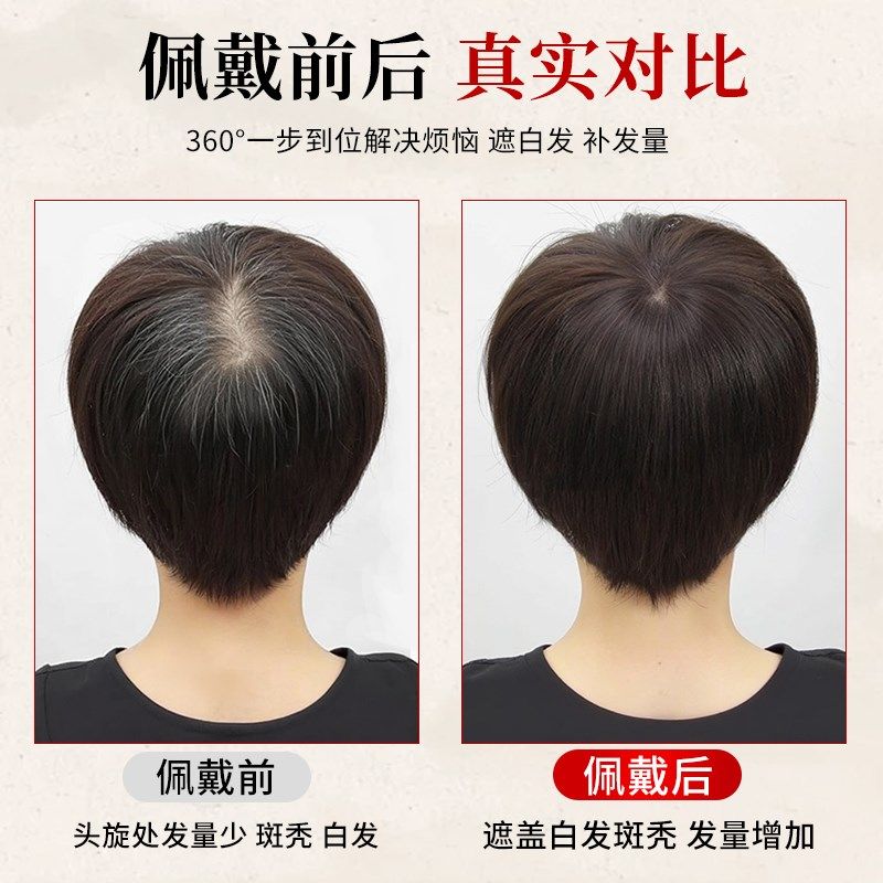 短发假发女头顶补发片遮白发蓬松增发量全真发自然轻薄刘海假发片