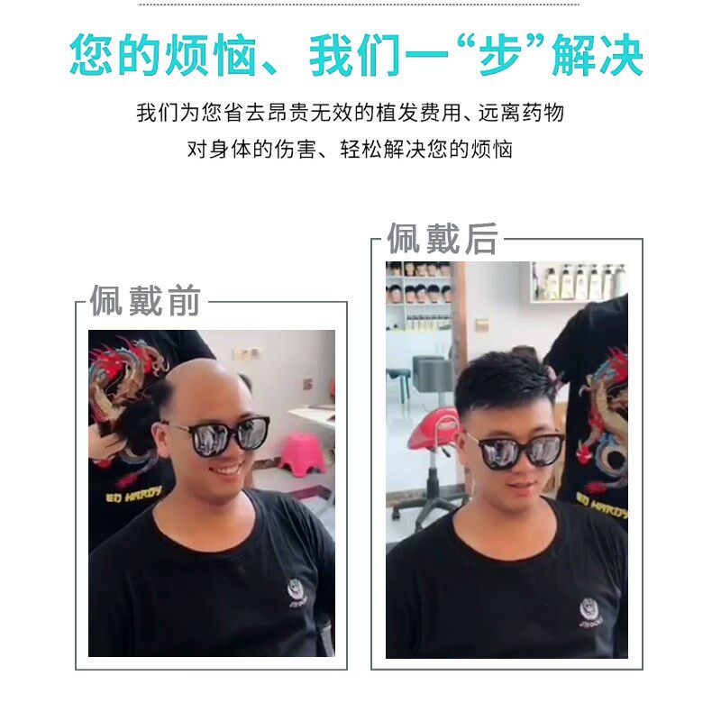 男士全生物头皮假发超薄无痕头顶补发片真人发蓬松增发量前额隐形