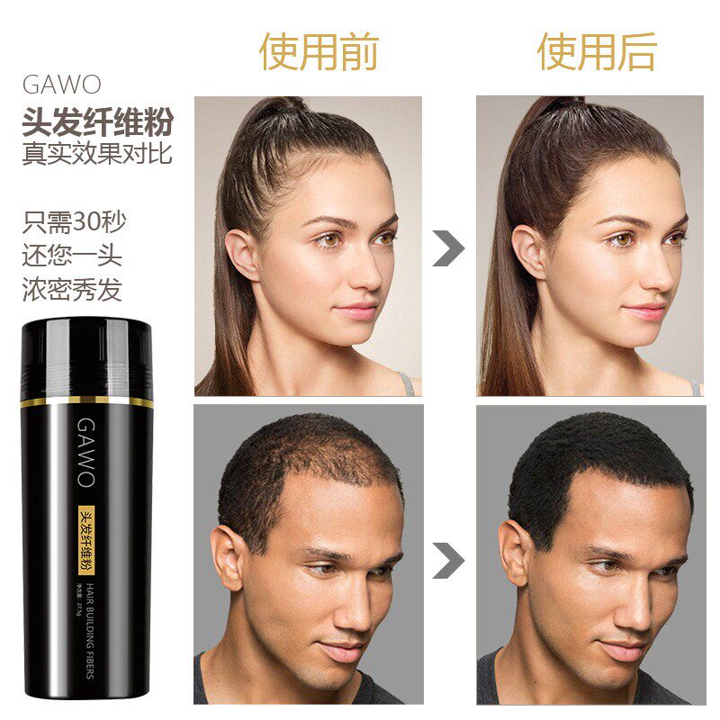 gawo头发纤维粉顶速密发增发纤维粉头发填充补发神器头顶稀少美发