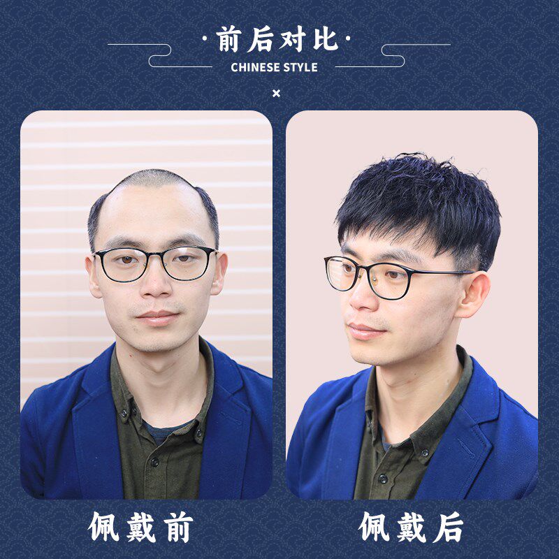 假发男短发全真发头顶补发片男式假发烫发栗子头自然隐形假发贴片