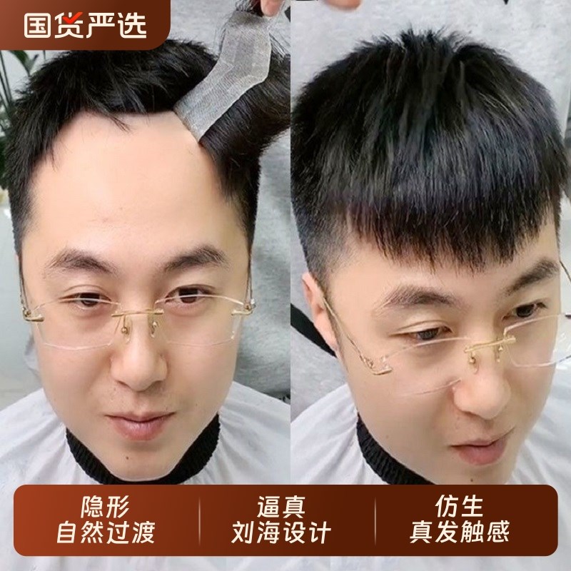 真发假发男士假发片前额隐形贴发际线男头顶补发块男生假刘海片