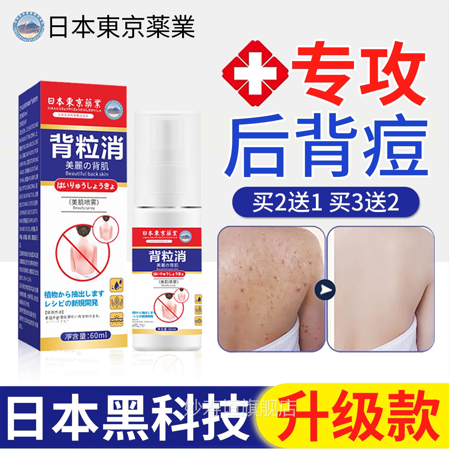 日本背粒消喷雾螨前胸后背祛痘背后除螨去除背上痘痘背部除虫粉刺