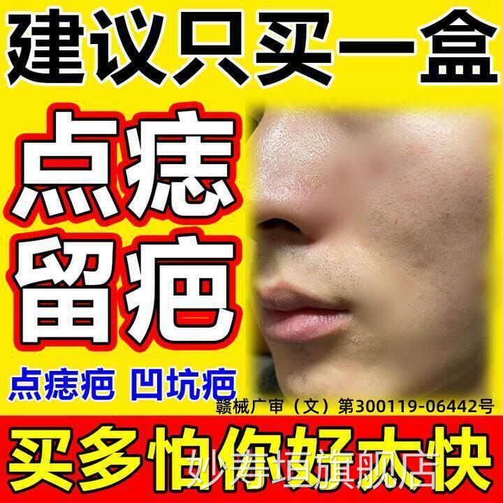 点痣后去疤痕修复膏祛疤膏红印去黑印色素沉增生点斑用修淀复液妙