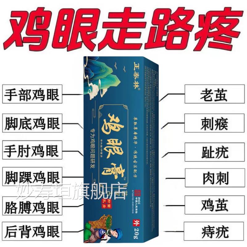 【苗家古方】鸡眼膏鸡眼菌液滁脚趾手抑指鸡眼肉刺顽固除反复生长
