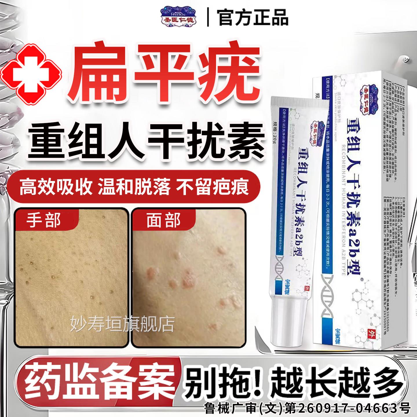 重组人干扰素a2扁平疣专用去除软膏一抹灵去b2根凝胶官方旗b舰店
