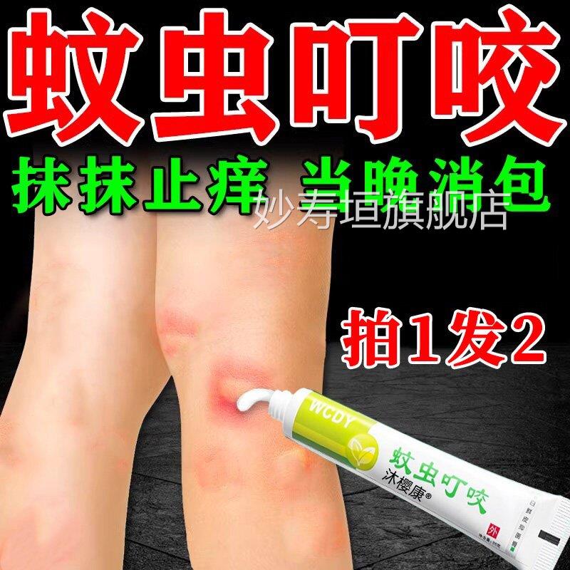 蚊虫毒叮咬快速止痒消红软膏婴宝宝成人儿童臭虫跳蚤蚊子咬肿包膏