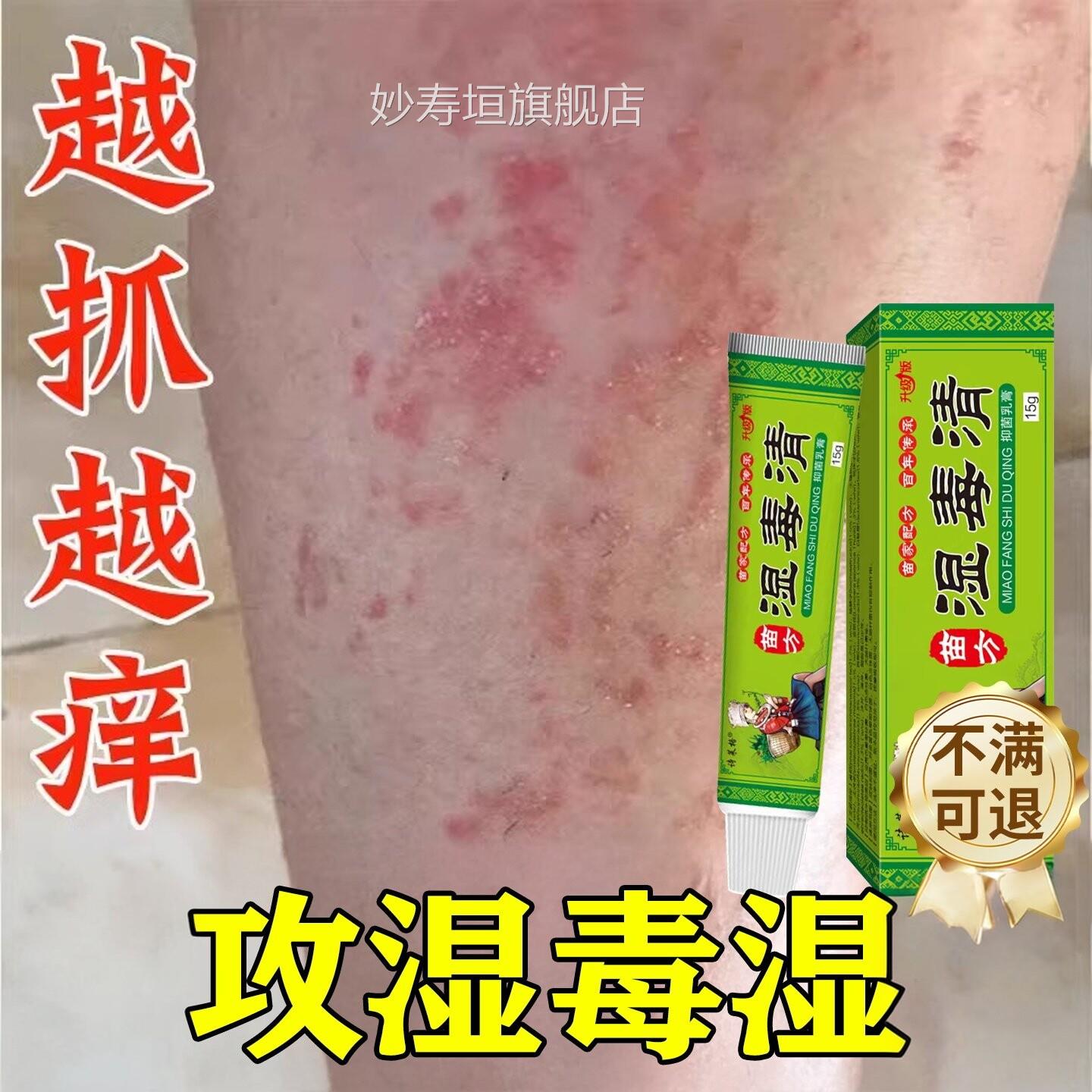 湿毒清软膏热止湿痒祛痒根皮肤皮瘙炎痒水泡湿治除湿用膏妙寿垣旗