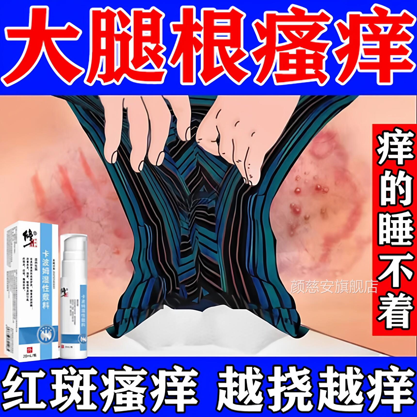 烧档膏药大腿内侧防摩女擦胖人夏天走路男根部潮湿出汗红肿磨破痛