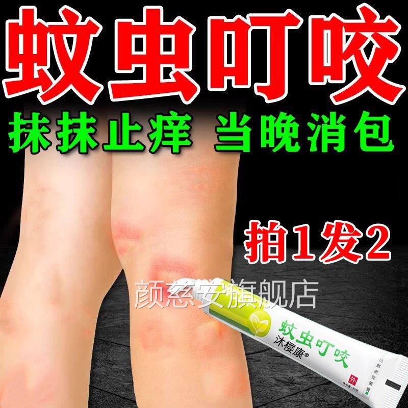 蚊虫叮咬快止痒消红软膏婴宝宝成人儿童臭毒虫速跳蚤蚊子咬肿包膏