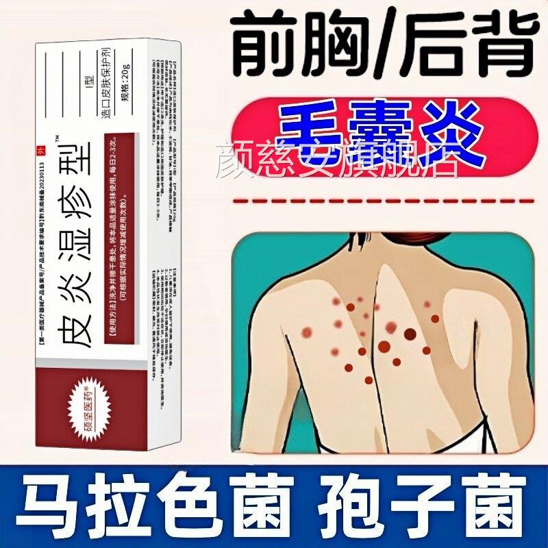 马拉色菌孢子菌毛囊炎痤疮痘痘脂溢性皮前炎胸后背肩部颈部毛囊炎