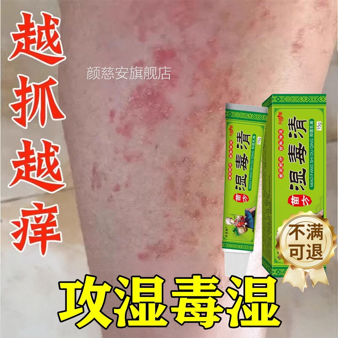 湿毒清软膏湿热止治湿痒祛痒根皮肤皮瘙炎痒水泡除湿用膏颜慈安旗