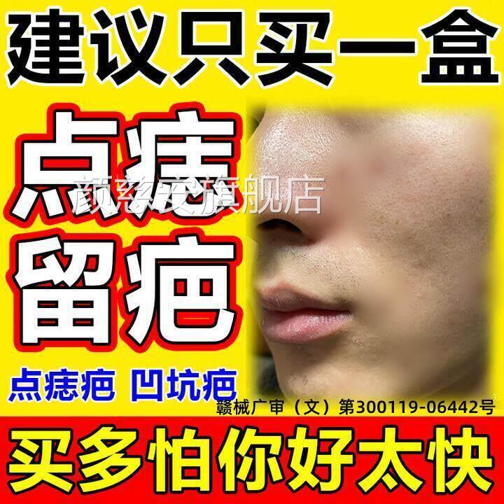 痣点后去疤痕修复膏祛疤膏红印去黑印色素沉淀增生点斑用修复液颜