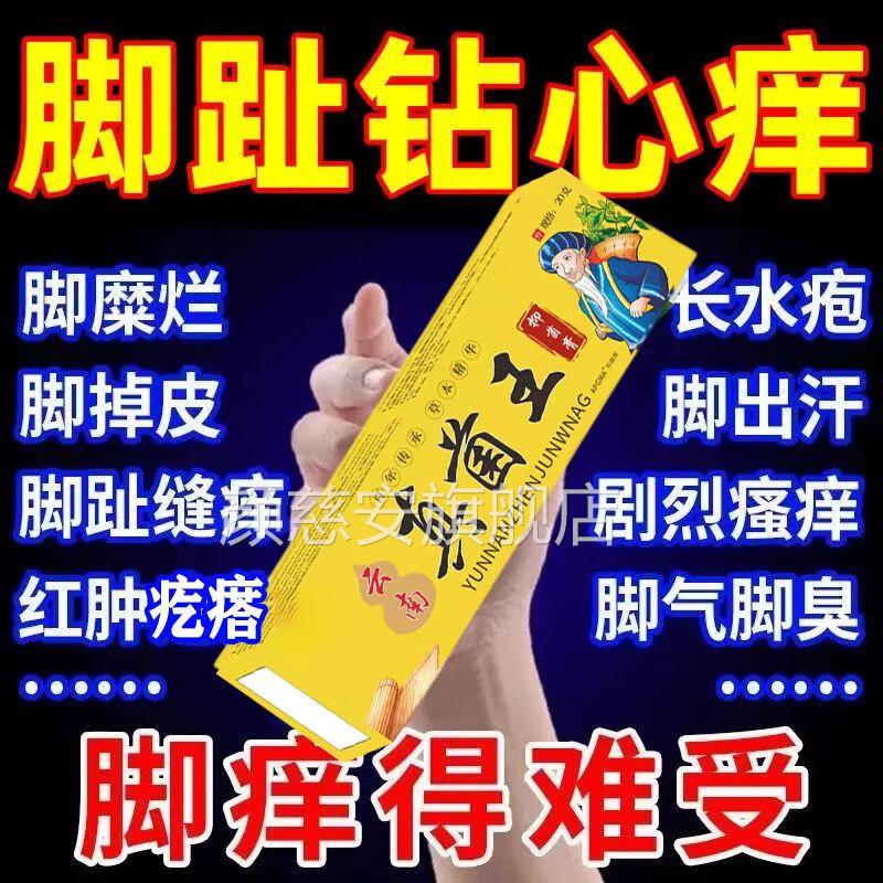 云南真真菌王官方旗舰店正品脚气痒水泡脱皮臭香港脚菌感染止痒膏