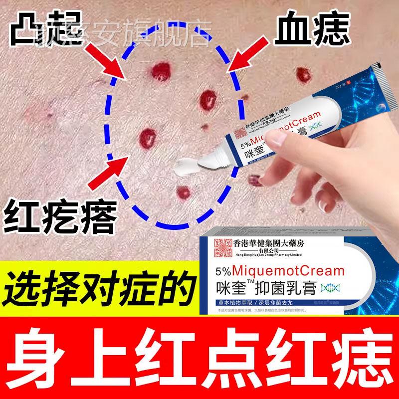 血管瘤血管痣专去除用红痣蜘蛛点痣疣痣无痕正品凝胶可搭膏药贴颜