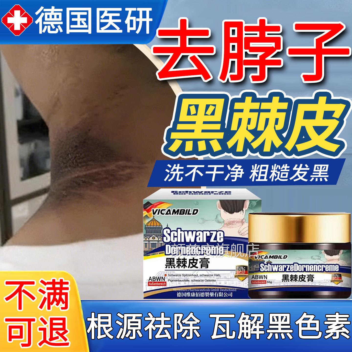 去脖子黑棘皮药膏病治黑色素沉淀淡化神器肥胖儿童颈肤部皮变白除