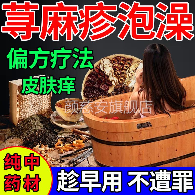荨麻疹中药泡澡包过敏止提高免疫力痒治慢性荨麻疹过敏泡澡包颜慈