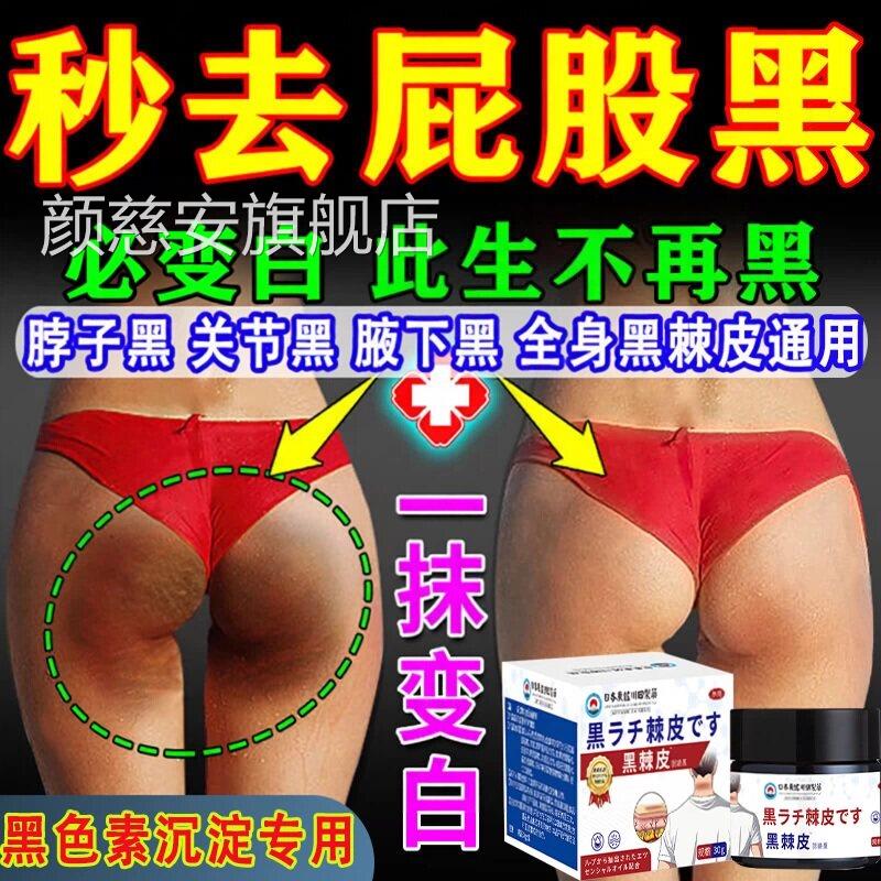 日本脖子大腿内侧黑色棘素沉淀去除屁股祛坐印臀部发黑坐茧黑皮膏