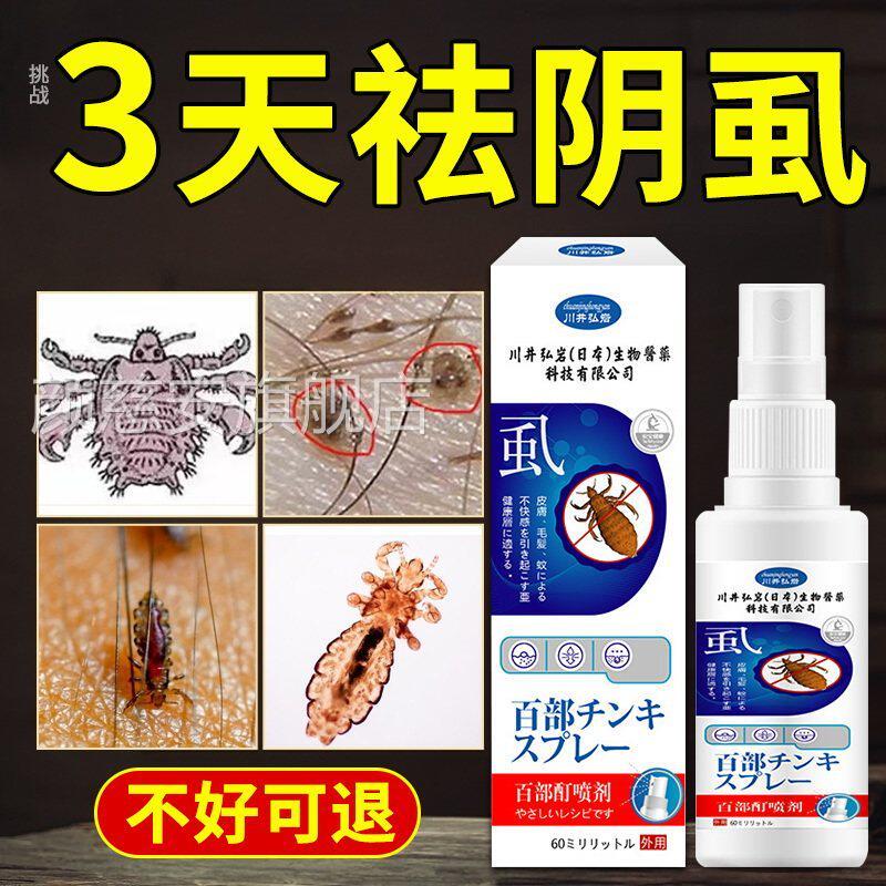 百部酊灭去阴虱喷虫卵头虱双杀一扫光剂蚊虫叮咬正品喷雾男女私处