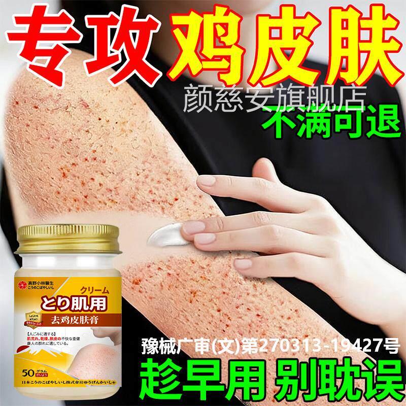 去鸡皮肤鱼鳞疙瘩毛囊角化症角质膏手臂神腿胳膊上疙瘩鸡皮去除器