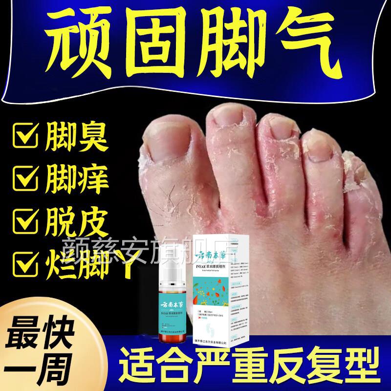 脚气止痒脱皮杀菌脚痒水泡烂脚药丫真菌喷雾膏非治糜烂脚趾缝烂痒