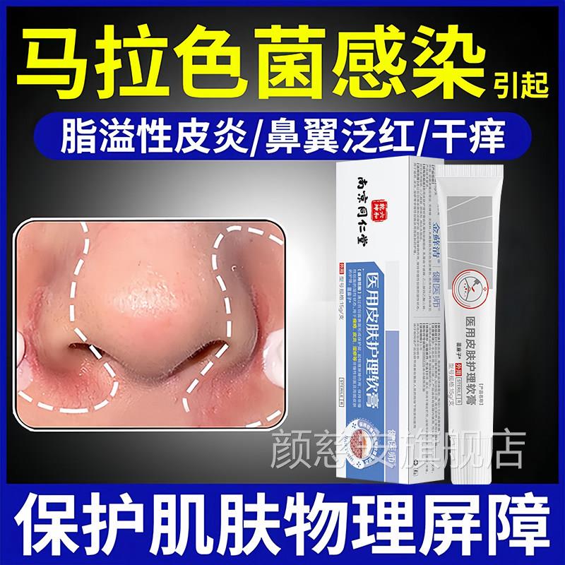 鼻翼脂溢性皮炎面部面霜软膏鼻子两侧发红脸皮上肤干燥起皮脱皮颜