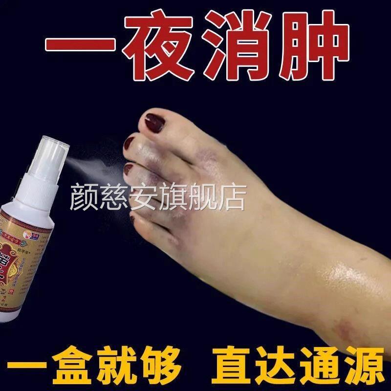 去水肿消特效的药老人脚肿消肿的活药消肿止痛喷剂血化瘀外用专用