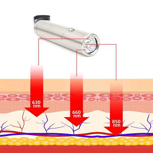 多功能可拆卸5分钟定时630nm660nm850nm 9wLED红光红外理疗手电筒