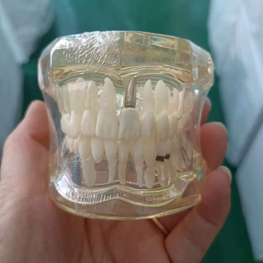 透明标准模型  28颗牙,不带托槽   牙齿模型