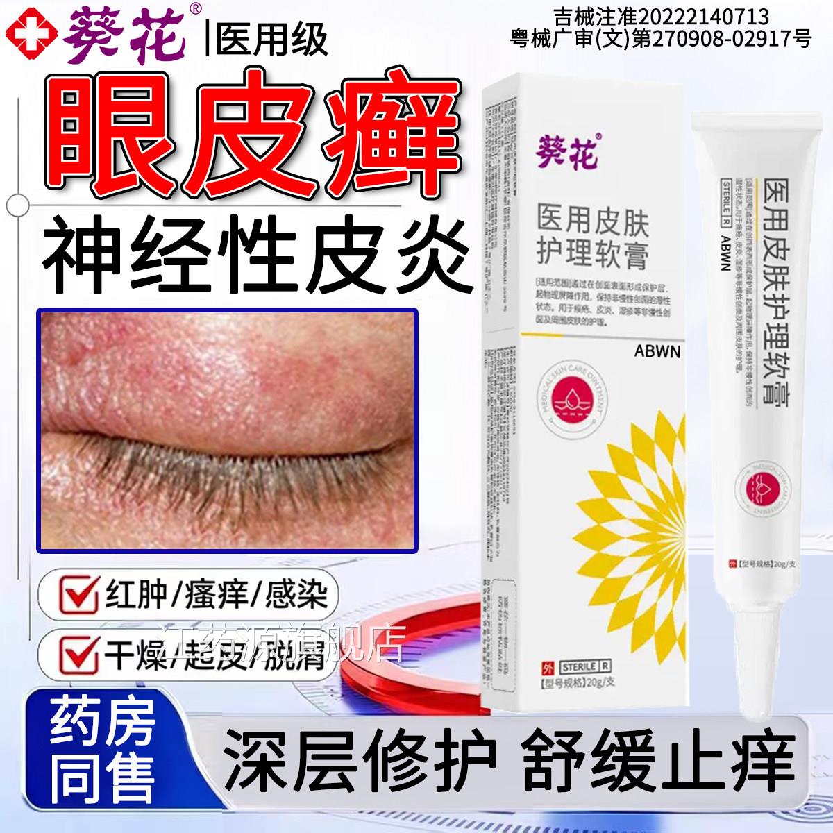 眼皮癣神经性围皮炎眼睛周眼角痒干燥起皮掉屑消红肿过敏特药效膏