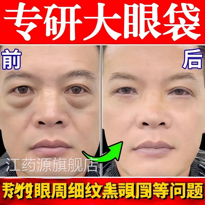 眼袋排肿膏消液严重肿强力去眼消男除袋神士器一分钟克专用霜星江