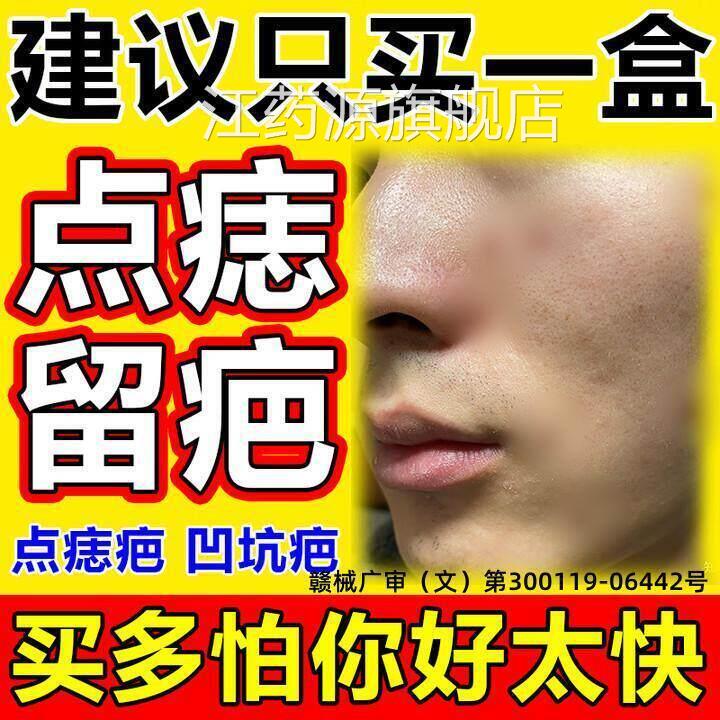 点痣后去黑疤痕修复膏祛疤膏红印去印色素沉淀增生点斑用修复液江