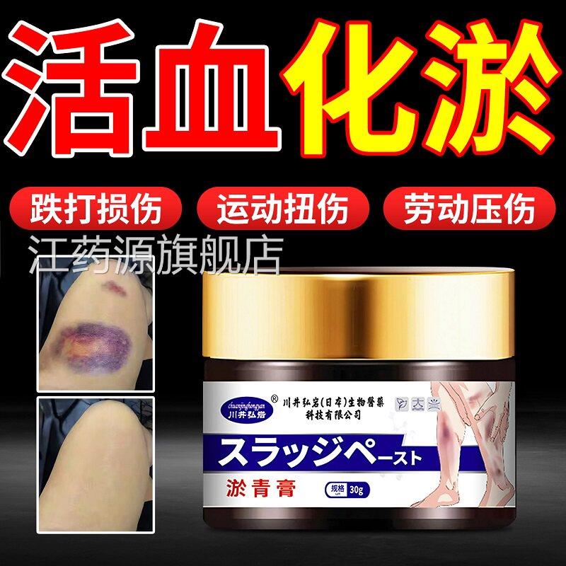儿童淤青膏活血化瘀淤青快速消除伤摔伤散淤血成人撞消肿跌打损伤