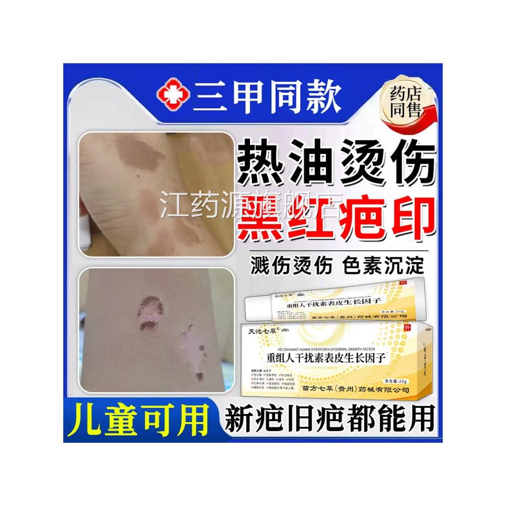 热油油烫伤烧伤沉去疤膏疤痕修复除疤膏儿童祛去红印黑印色素淀江