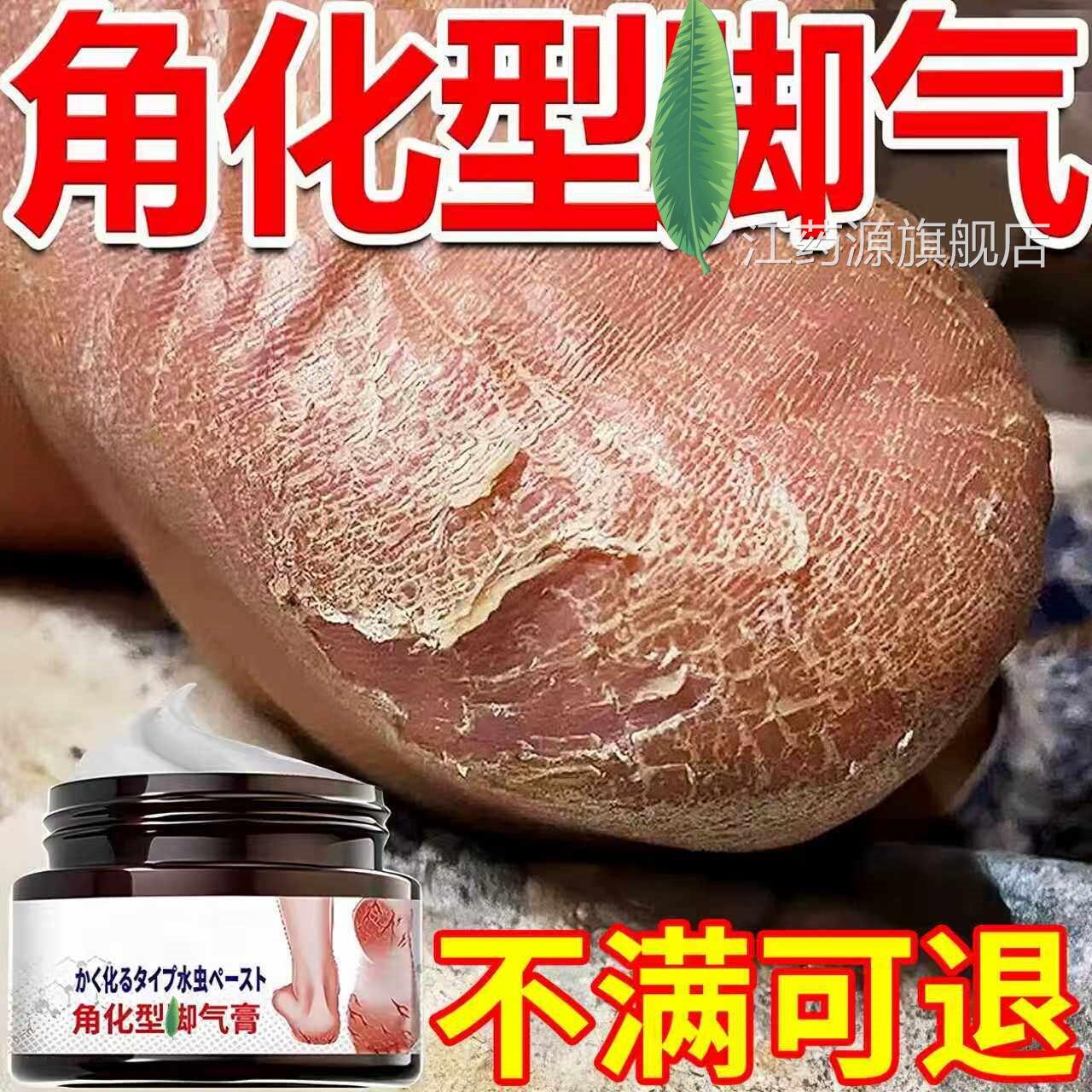 日本角化型脚i气脚后跟干裂开裂脱皮染专用特杀菌真菌感止根效痒