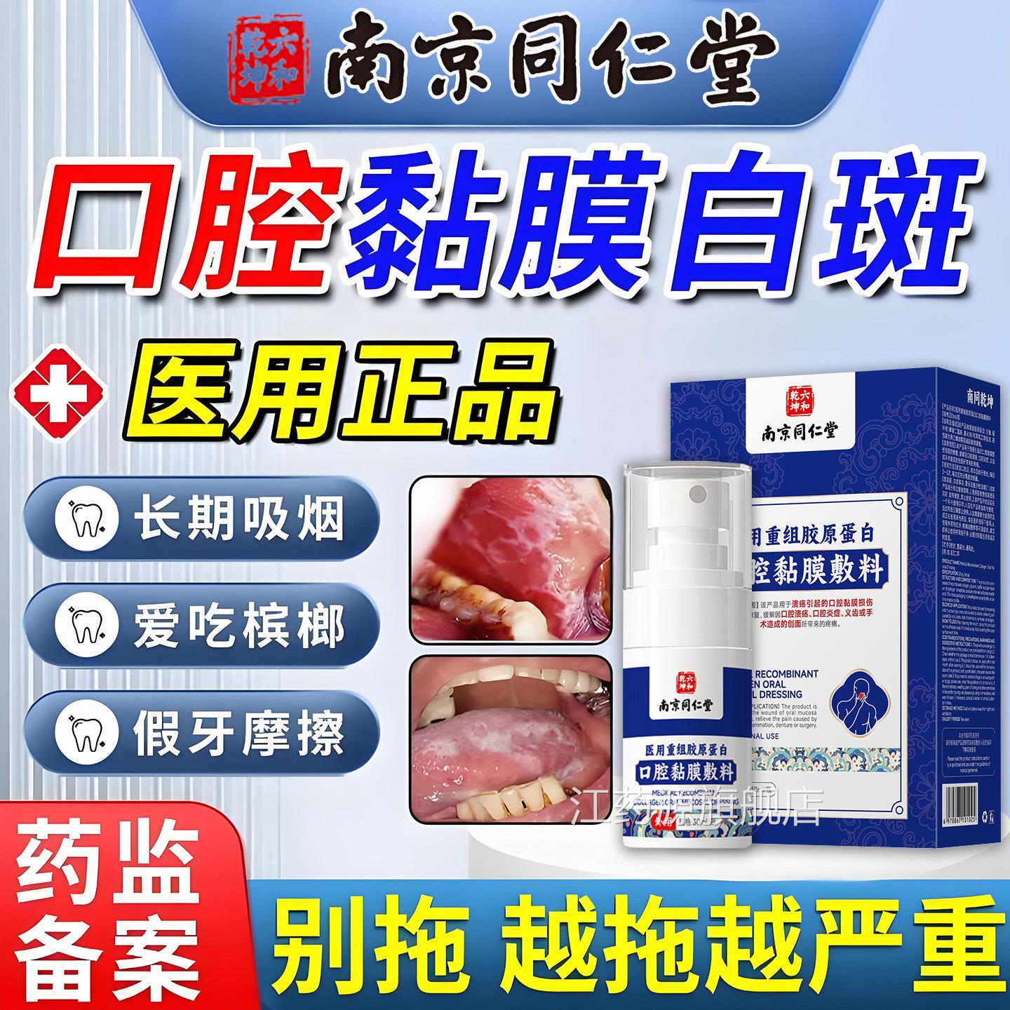 口腔扁平苔藓专用腔溃疡喷剂一点灵纤维化修复口黏膜白斑口舌起泡