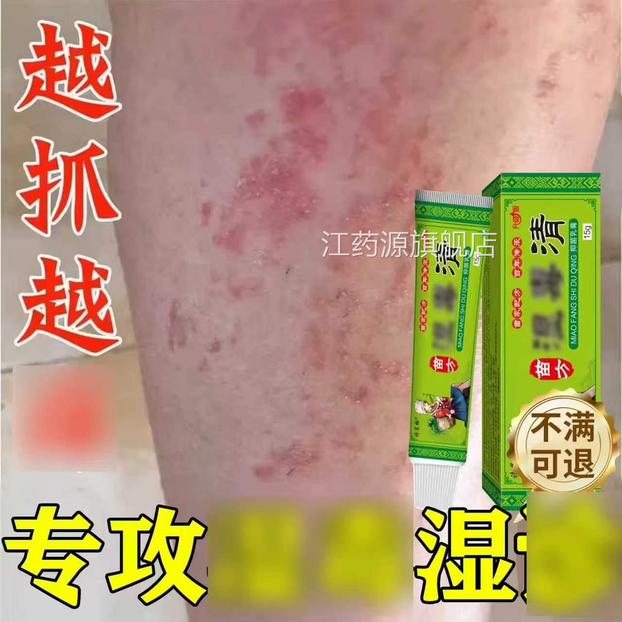 湿毒清干燥肤私处阴囊止皮痒抑软菌膏男女外用旗舰店官方皮正品江